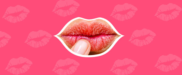 A Complete Guide On Dry Chapped Lips: What It Is, Causes, Symptoms & Home Remedies