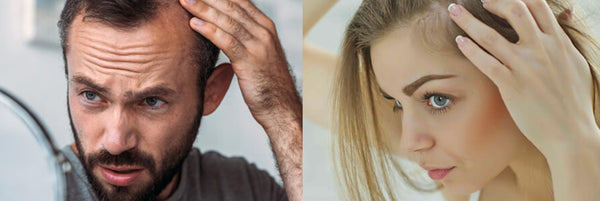 6 Lesser-Known Hair Fall Causes in Men and Women