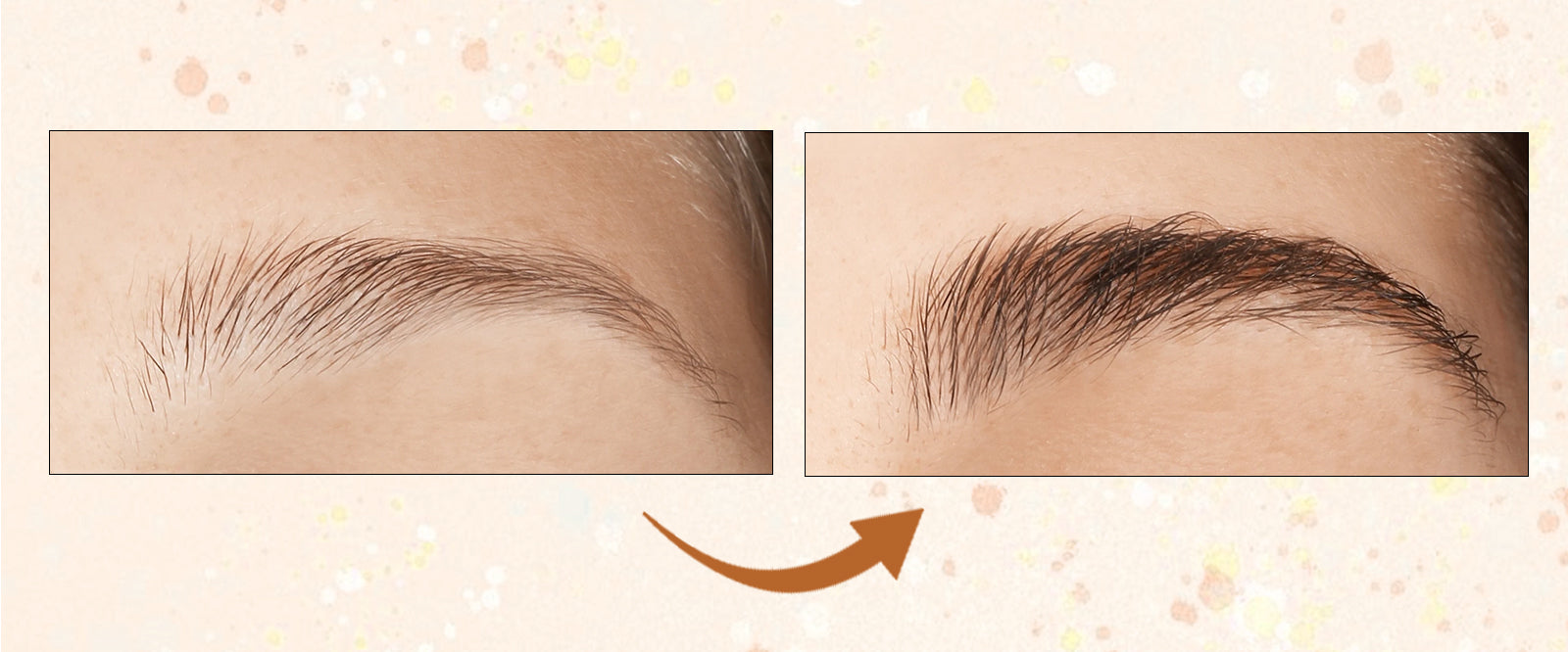 How to Grow Eyebrows Fast? 6 Easy Hacks