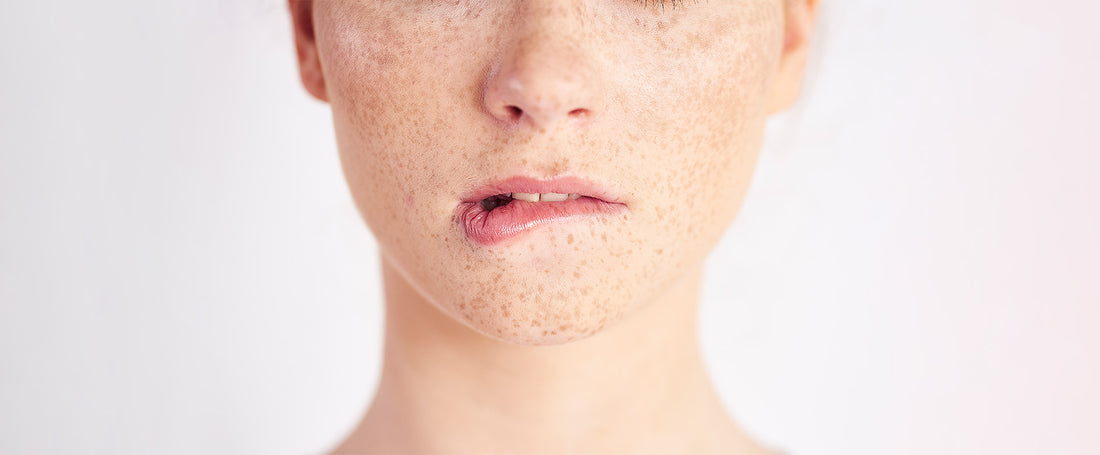 how to reduce pores