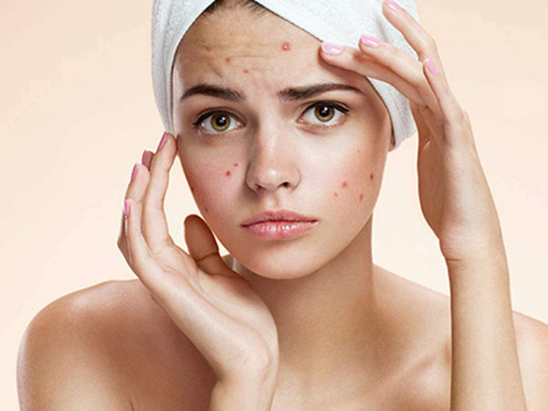 Do you know the best skin care routine for acne prone skin?