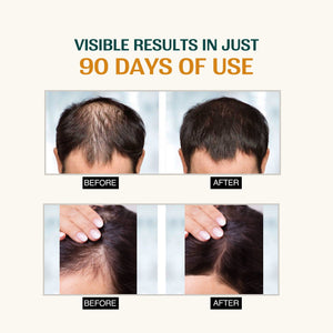 Advanced Hair Growth Serum with Rosemary Extract