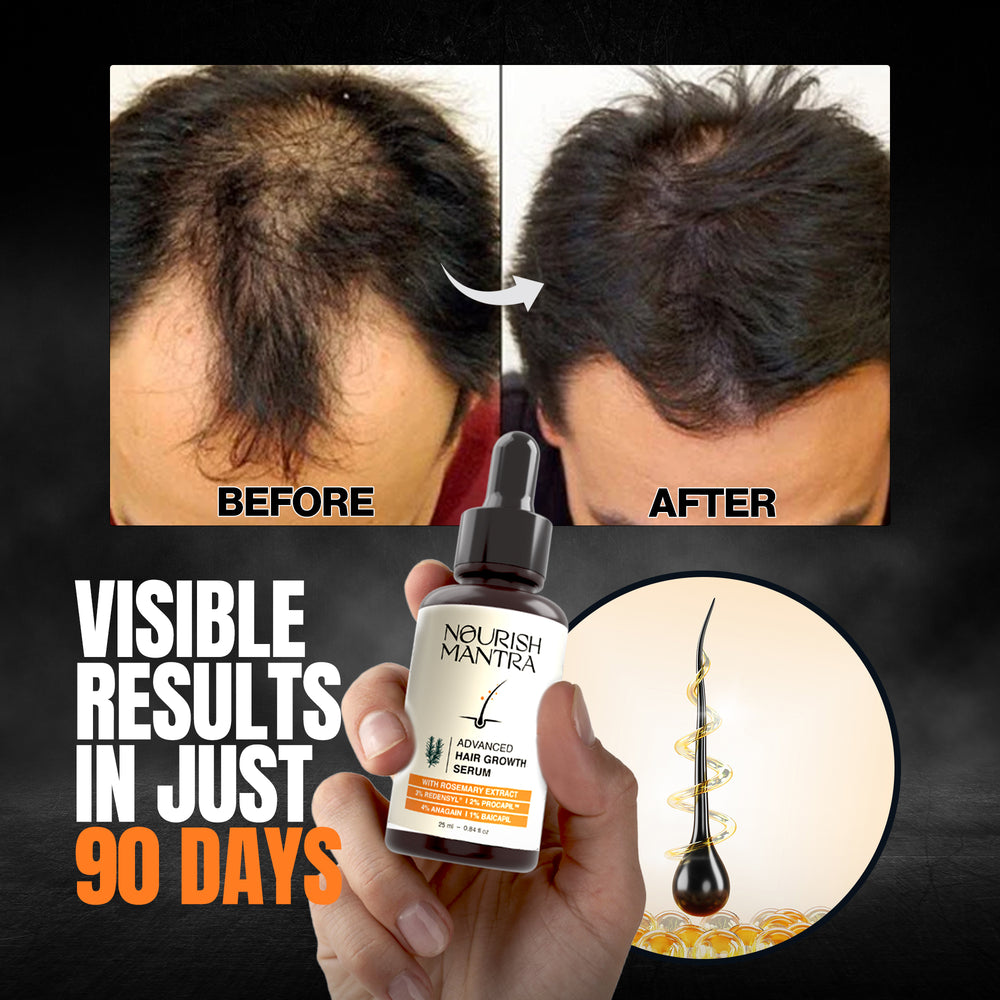 Advanced Hair Growth Serum with Rosemary Extract (Pack Of 2)